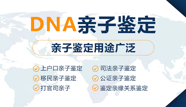 黔东南上户血缘检测如何做,黔东南迁户血缘检测多久可以出结果